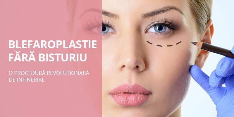 Clinica SANCOS vă prezintă o procedură revoluționară de întinerire: Blefaroplastie fără bisturiu!