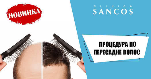 Пересадка волос - радикальный и наиболее эффективный метод восстановления волос на голове человека…