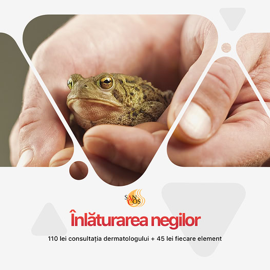 ÎNDEPĂRTAREA VERUCILOR DE PE MÂINI ȘI PICIOARE (POTRIVITĂ PENTRU ADULȚI ȘI COPII)