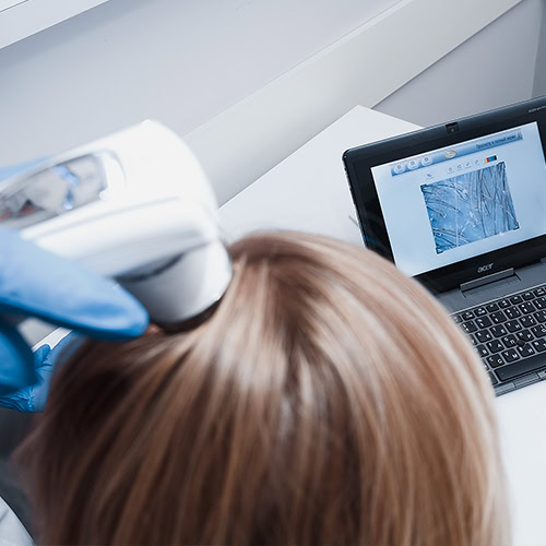 O fototricogramă este un tip de diagnosticare computerizată care furnizează cele mai exacte…