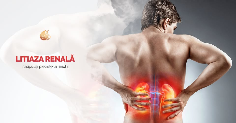 Litiaza renală – sau popular nisipul și pietrele la rinichi – reprezintă o modificăre metabolică…