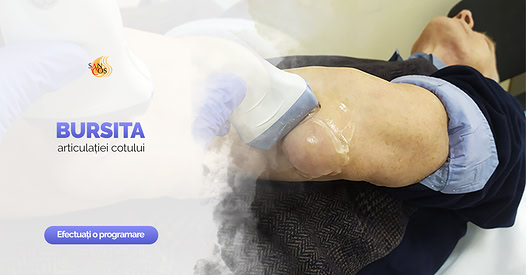 Bursita articulației cotului reprezintă inflamaţia unui ţesut moale aflat între piele şi os la…