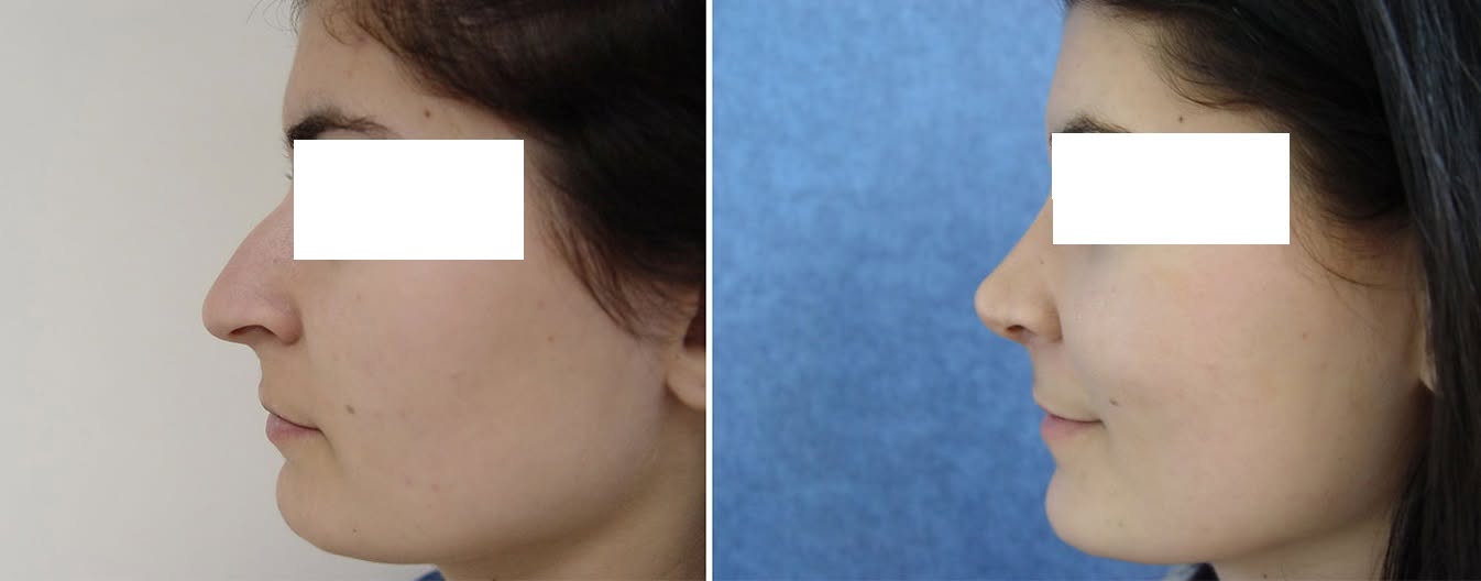 Atitudinea face diferența!