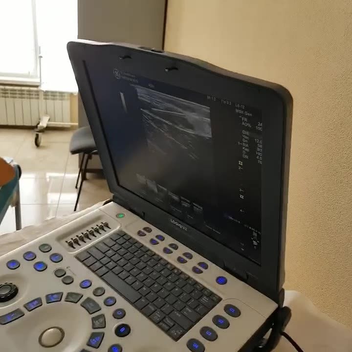 💉 Puncția ecoghidată a chistui Baker