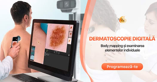 Dermatoscopia analizează suprafeța pielii și a formațiunilor existente - nevi (alunițe), papiloame…