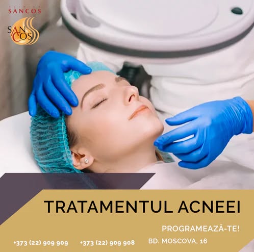 🔺Acneea reprezintă o afecțiune inflamatorie provocată de foliculul sebaceu, care infundă porii cu…