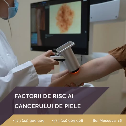 ❗️Cancerul de piele este o patologie cu o incidență în constantă creștere, dar care poate fi ușor…