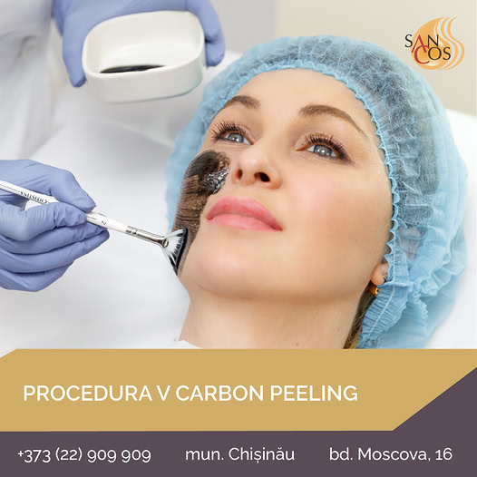 Procedura V Carbon peeling. Acum cu reducere❗️