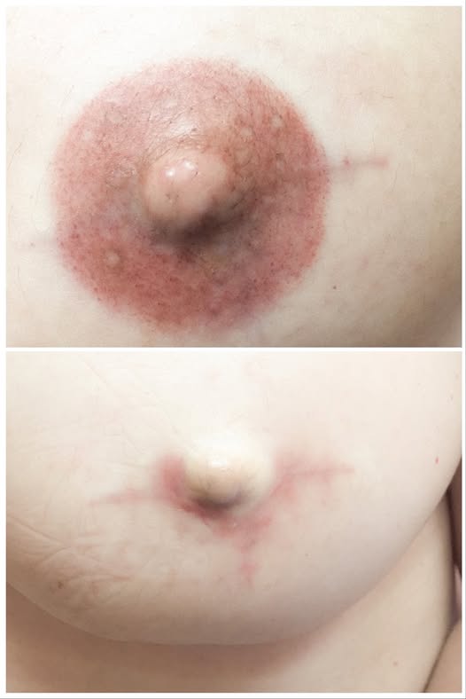 Avem nevoie de modele pentru tatuaj paramedical!