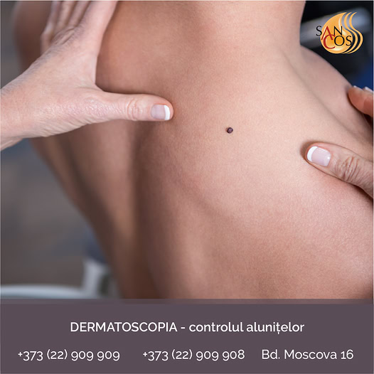 În ultima perioadă, în cadrul clinicii noastre se atestă o creștere sporită de adresări la medicul…