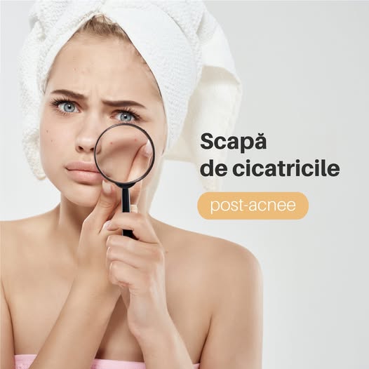 Știai că petele maronii, cicatricile post-acnee și chiar ridurile faciale pot fi tratate prin…