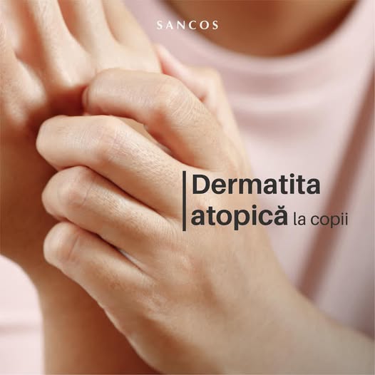 Ți-e cunoscut cuvântul eczemă? De fapt, este dermatita atopică și ea e cea mai frecventă boală…