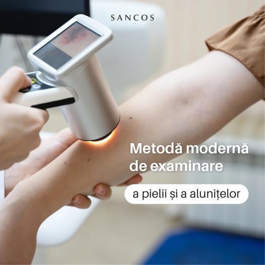 Harta dermatoscopică reprezintă cea mai modernă metodă de examinare a pielii și alunițelor. Aceasta…