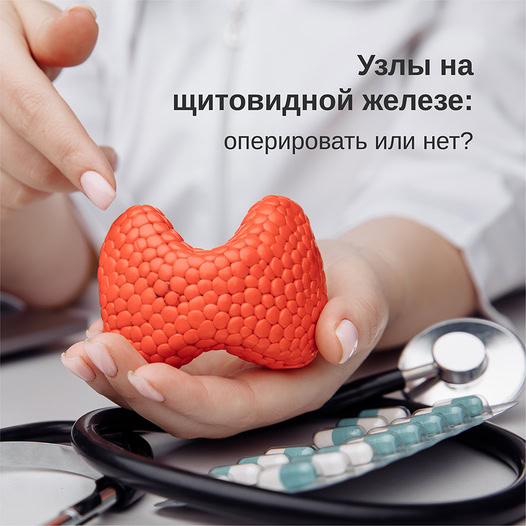 Узлы на щитовидной железе могут развиваться длительное время, никак при этом себя не проявляя.