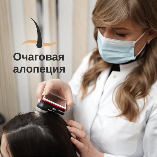 Очаговая алопеция: Что это такое и как её избежать?