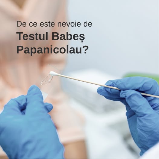 De ce testul Babeș Papanicolau este necesar?