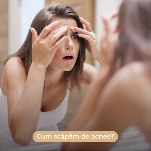❗Acneea este o afecțiune dermatologică întâlnită la peste 80% din adolescenți.