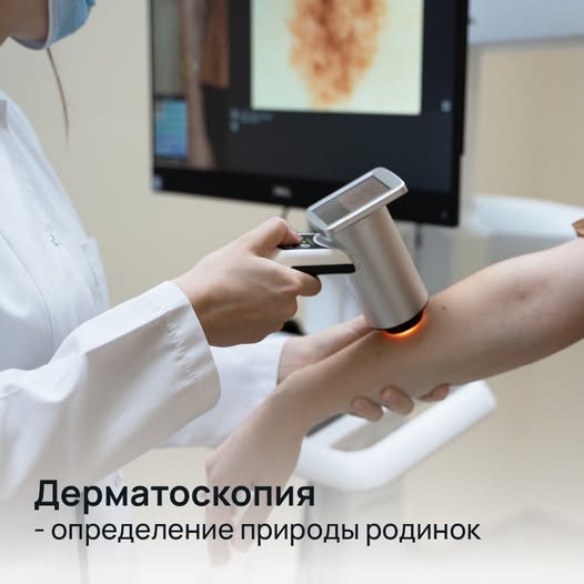 Чем могут быть опасны родинки и как может помочь дерматоскопия?