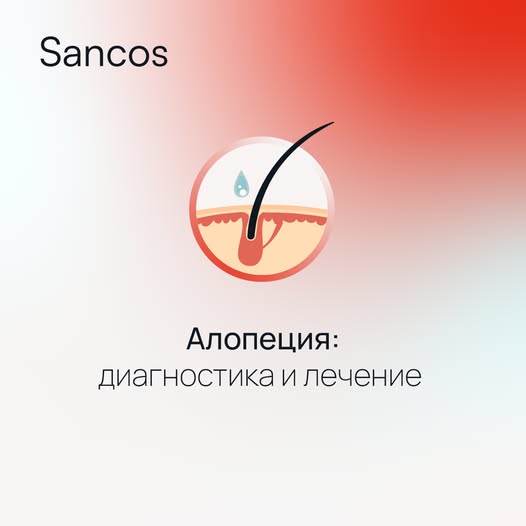 Существует много причин, способных вызвать нарушение роста волос, таких как очаговая, диффузная…