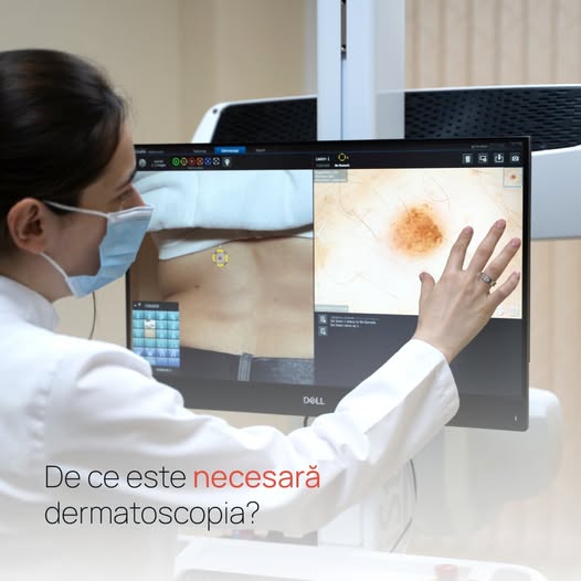 Dermatoscopia reprezintă o procedură modernă și rapidă de examinare a pielii cu ajutorul unui…