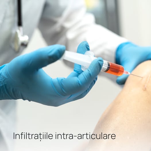 Ce sunt injectările cu acid hialuronic în genunchi?