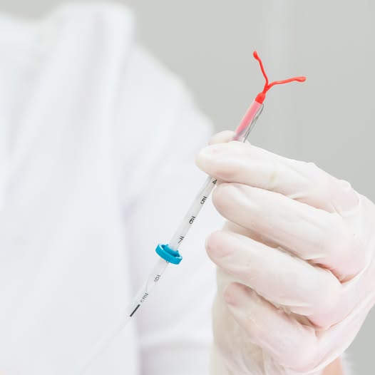 Te-ai hotărât să-ți montezi un sterilet și vrei să te simți mai pregătită pentru procedură?