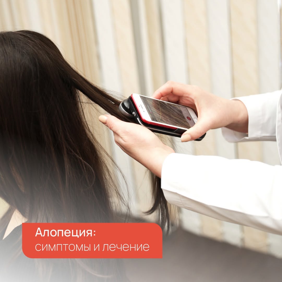 Алопеция - болезнь, при которой происходит истончение волос, их повреждение и частичная или полная…