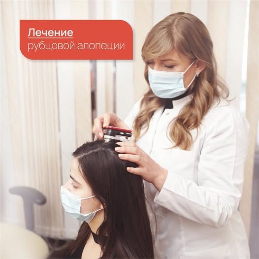 Рубцовая алопеция: Что это такое и как её лечить?