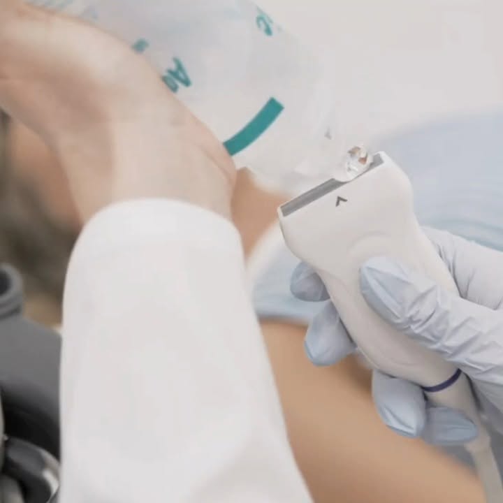 De ce este important să faci o ultrasonografie periodică?