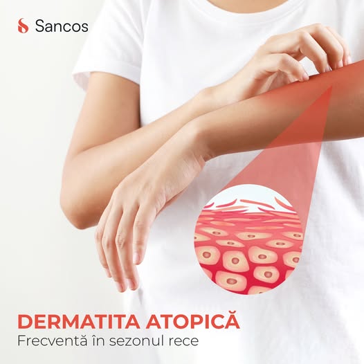 Temperaturile extreme, umiditatea ridicată sau chiar scăzută și uneori expunerea la soare în…