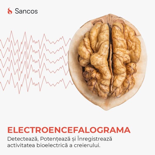 Dintre miile de invenții întâmplătoare, una care iese cu adevărat în evidență este cea a…