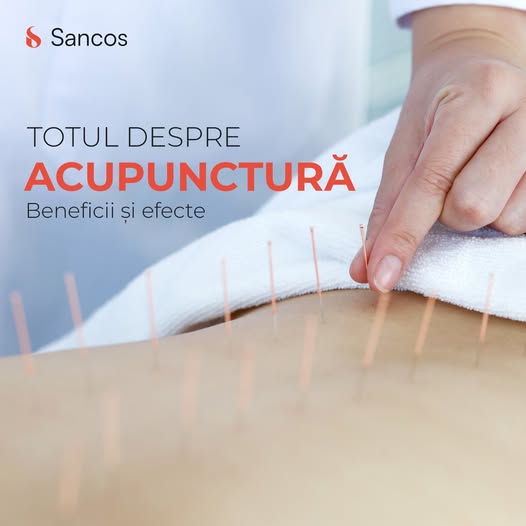 Acupunctura are o istorie de câteva mii de ani și ocupă un loc important în rândul mijloacelor de…