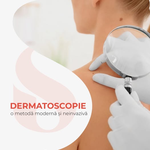 Știați că dermatologii recomandă examinarea alunițelor prin intermediul dermatoscopiei cel puțin o…