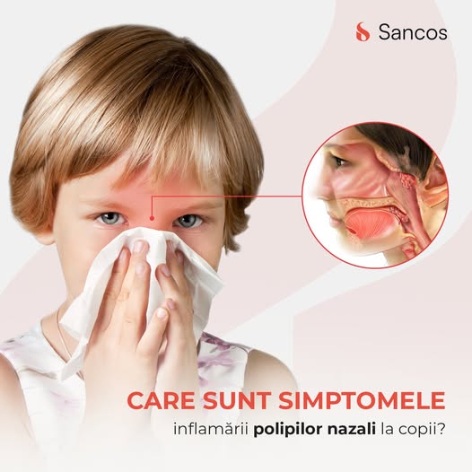 Inflamarea polipilor nazali la copii sunt una dintre cele mai cunoscute patologii pediatrice din…