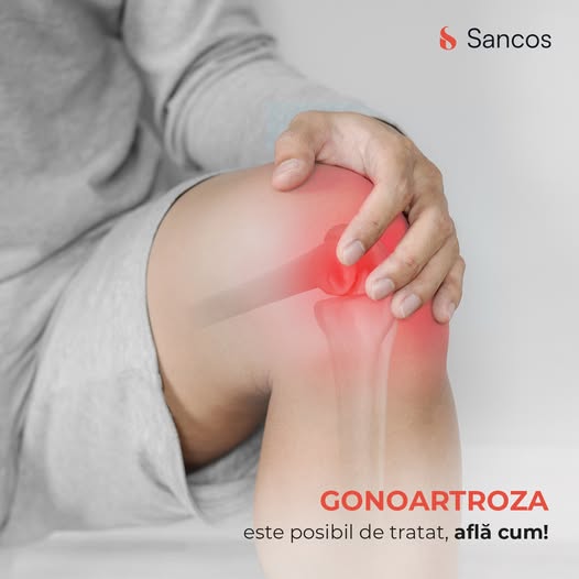Gonartroza poate fi tratată!🦵