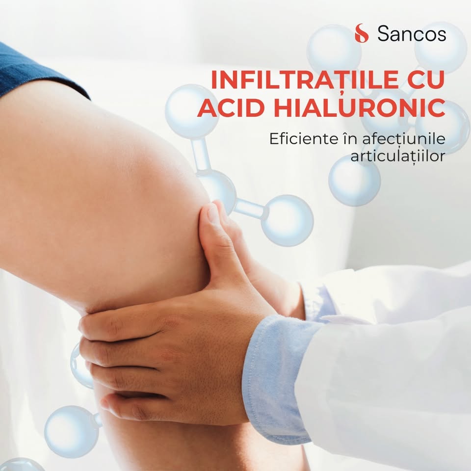 👩🏼‍⚕️ Tratamentul prin infiltrații intraarticulare cu acid hialuronic are rezultate excelente de…