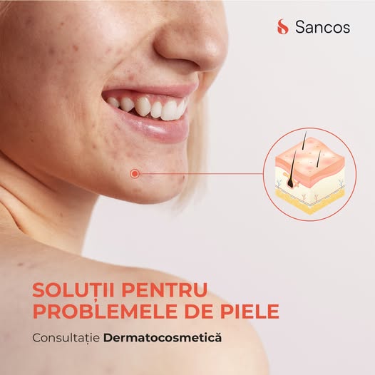 Clinica Sancos – locul în care frumusețea întâlnește știința, oferindu-ți cele mai bune soluții…