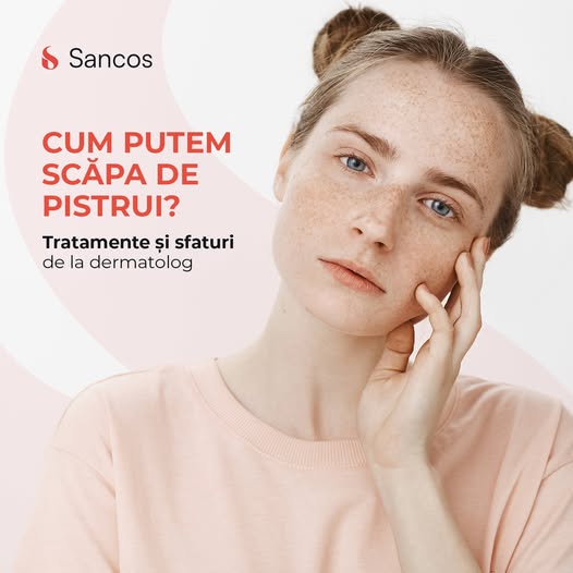 👉În timp ce unii consideră pistruii o problemă estetică, alții îi văd ca pe un farmec personal.…