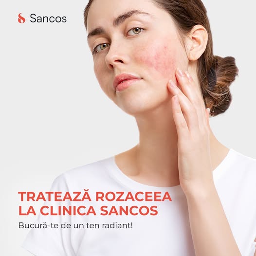 🙍‍♀️Rozaceea este una dintre cele mai frecvente patologii dermatologice ce afectează milioane de…