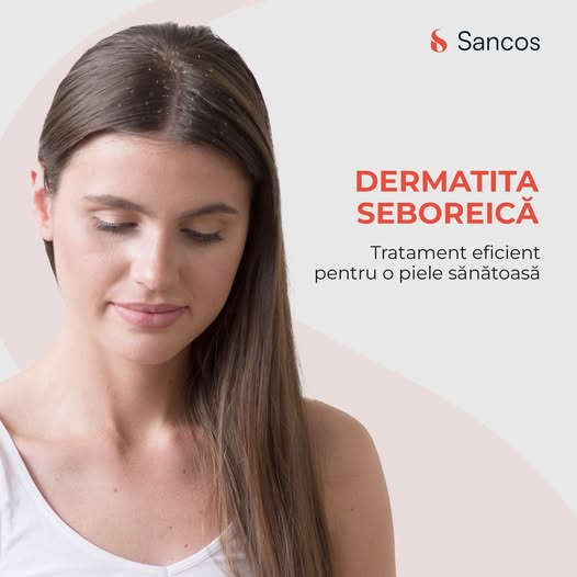 👉Deși cauzele dermatitei seboreice nu sunt încă pe deplin înțelese, specialiștii în tricologie de…