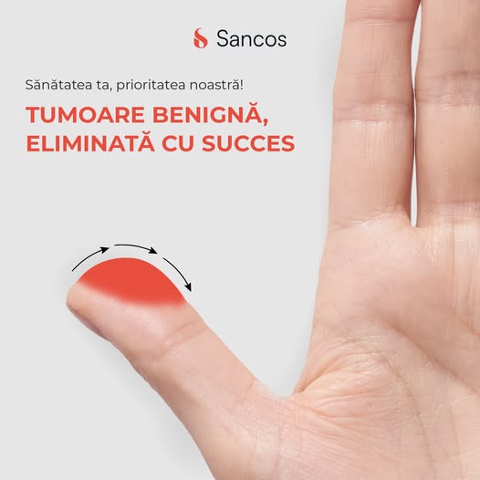 ❗️La Clinica Sancos, misiunea noastră zilnică este să promovăm și să protejăm sănătatea pacienților…