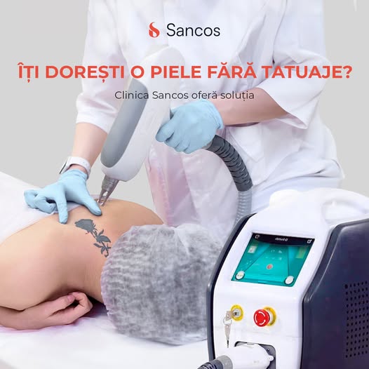 💫 Ai un tatuaj pe care vrei să îl înlături? La Clinica Sancos, oferim proceduri sigure și…