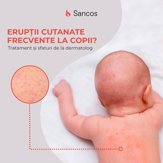 👦 Pielea copiilor trebuie să aibă o culoare uniformă, netedă, catifelată și hidratată. Totuși din…