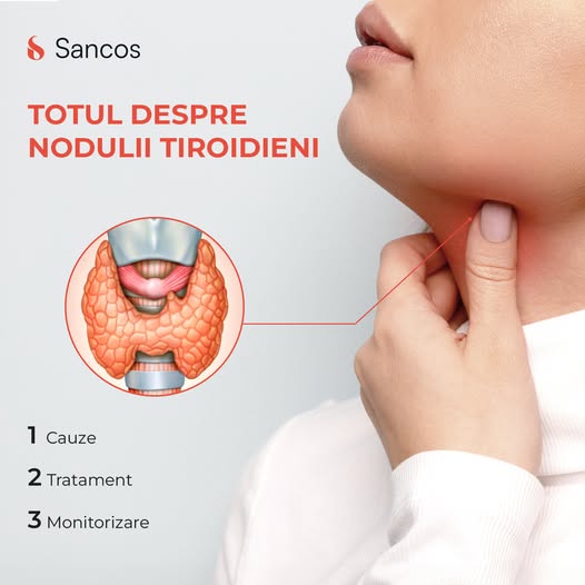 🧏‍♀️Cea mai frecventă cauză de adresabilitate la cabinetul medicului endocrinolog se datorează…