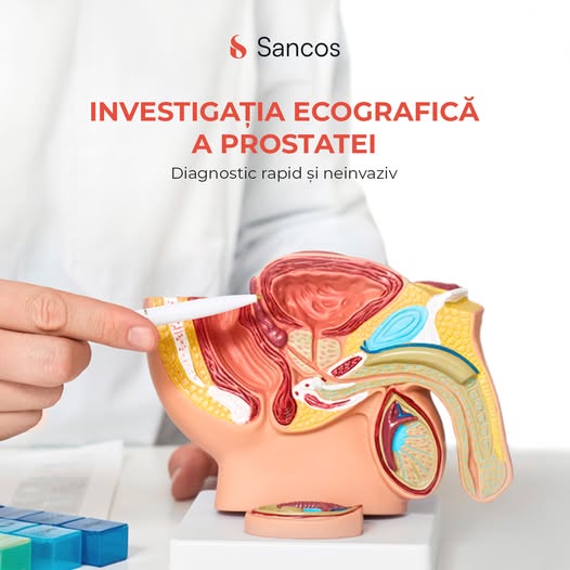 💁‍♀️Astăzi, Clinica Sancos pune în discuție subiectul tabu în rândul bărbaților “ecografia…