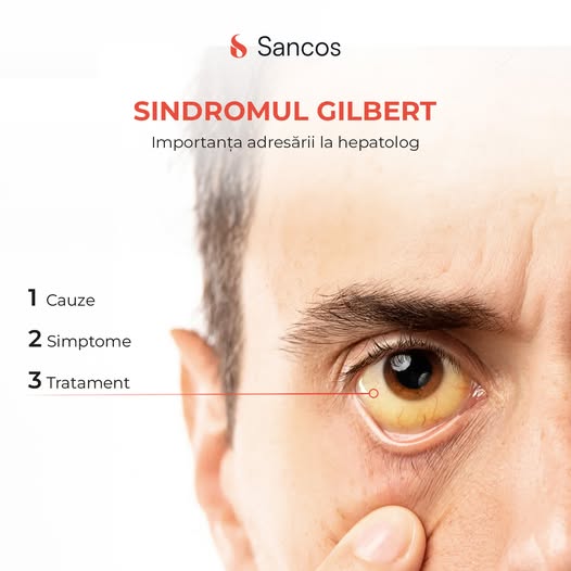 🧑‍⚕️Sindromul Gilbert este o afecțiune de cauză genetică în care organismul produce una dintre…