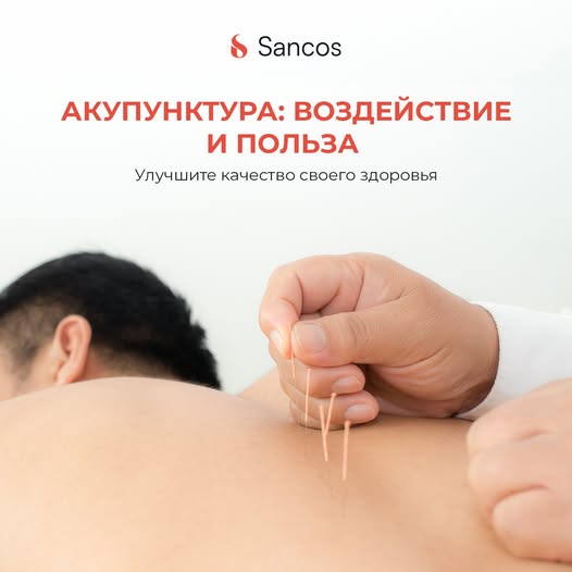 💁‍♀️Акупунктура или иглоукалывание используется в традиционной китайской медицине на протяжении…