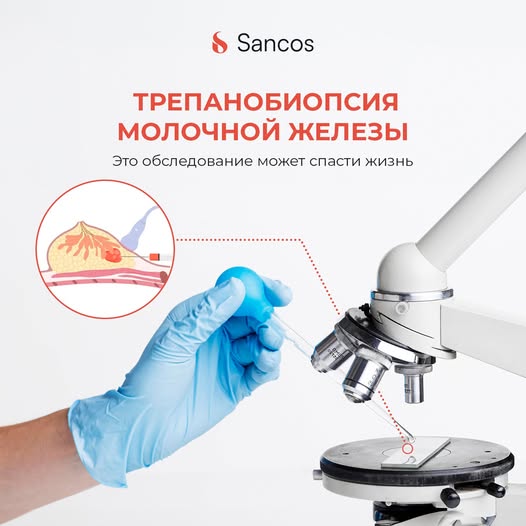 👩🏼‍⚕️Трепанобиопсия молочной железы может спасти жизнь!