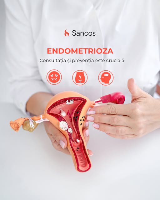 💊 Conform statisticilor, aproximativ 1 din 10 femei de vârstă reproductivă suferă de endometrioză…
