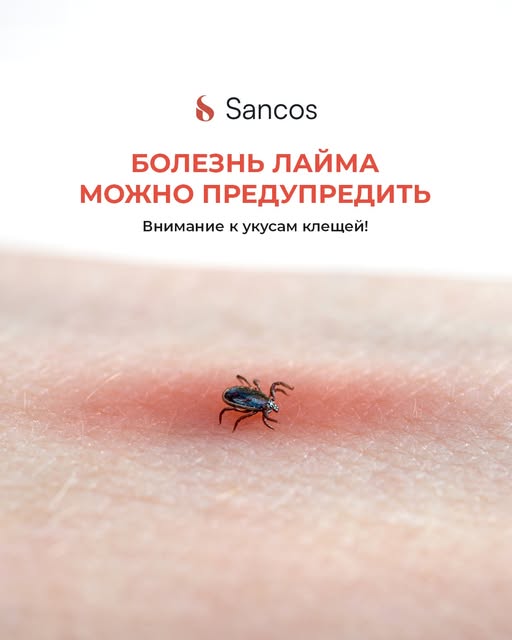 🌸 Весна так и подталкивает двигаться, выбираться на природу, наслаждаться чистым воздухом, однако…